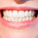 Śliczne zdrowe zęby również wspaniały prześliczny uśmiech to powód do płenego uśmiechu.